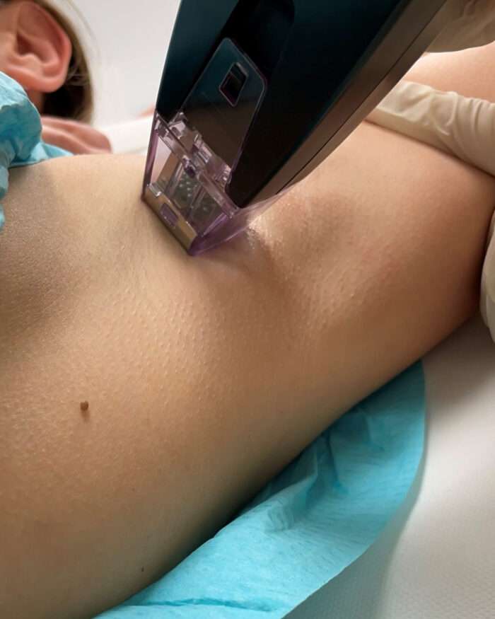 Tratamientos Estético Dermatológicos